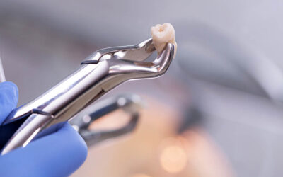 Wisdom Teeth 101: Understanding Your Oral Surgery Options